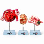 Nephron Kidney Globule